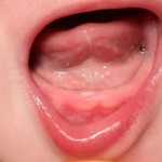 Teething and how to be shown up by your five year old child