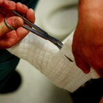 What a broken toe has taught me about family life