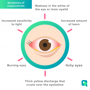 Guest Post; What You Need To Know About Conjunctivitis And Children 